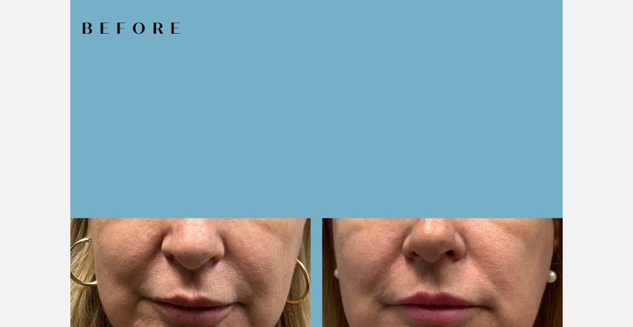 Neuromodulator Album